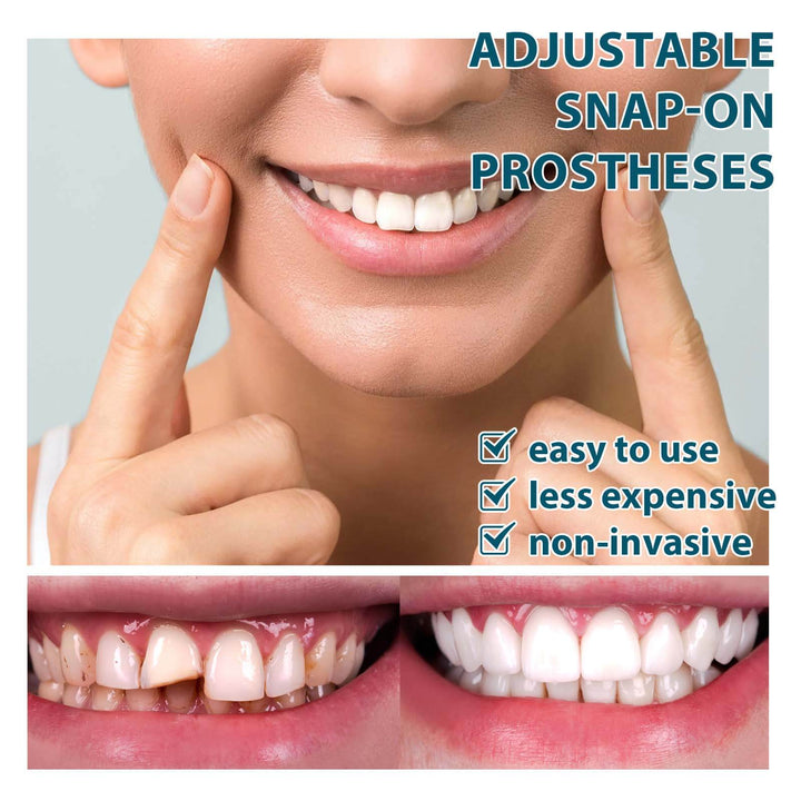 Advertisement for adjustable snap-on prostheses with a woman's smile and close-up of teeth. EELHOE Snap-on Dental Prosthetics for Gap Filling EELHOE Customizable Snap-on Dental Prosthetics Temporary Adhesive Gap Filling Tooth Correction Denture Set