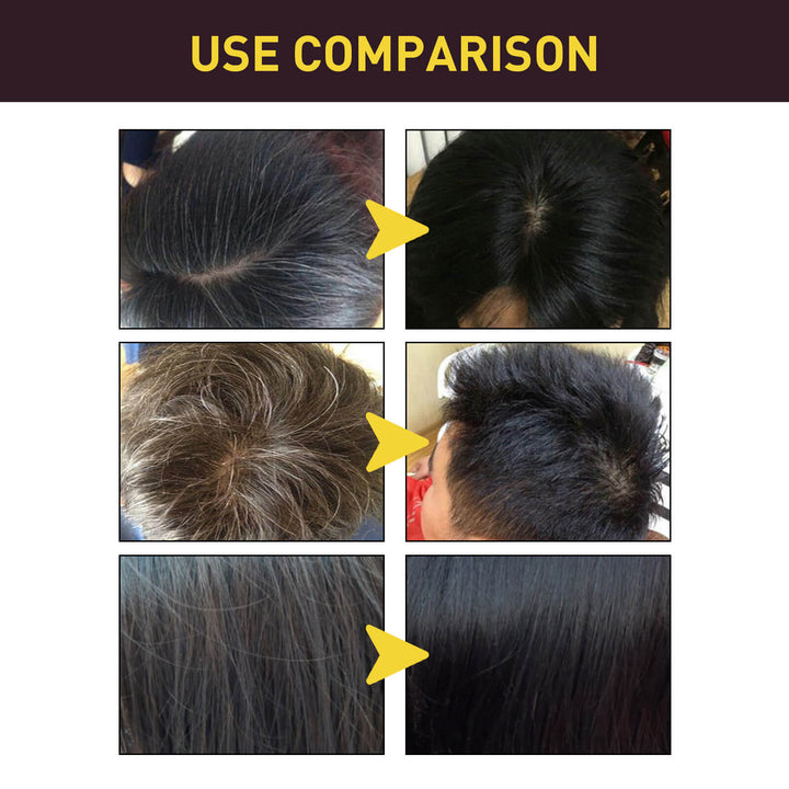 Before and after comparison of hair treatment on a person's head with text 'USE COMPARISON' at the top. EELHOE Dark Hair Cleanser for Natural Brunette Care EELHOE Dark Hair Cleanser (Natural Brunette) Essence of Polygonum Multiflorum Revitalizing Black Shampoo for Gentle Cleansing and Repair of Hair