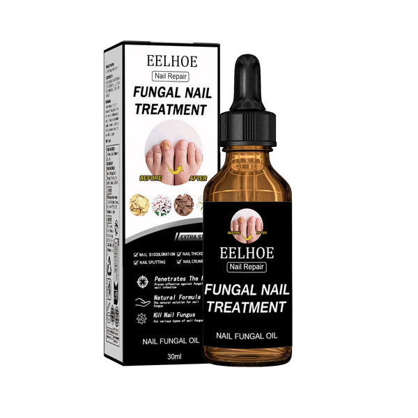 Eelhoe fungal nail treatment bottle and packaging on a white background EELHOE Nail Restoration for Healthy, Shiny Nails EELHOE Nail Restoration Solution Enhances the Thickness and Shine of Nails While Aiding in the Removal of Nail Fungus and Dead Skin, Providing Nourishing Hydration for Nail Care