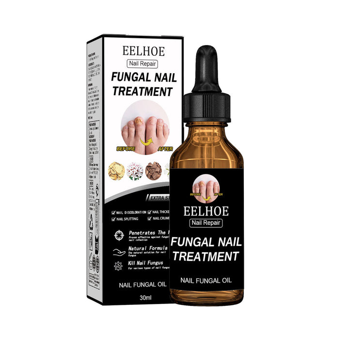 Eelhoe fungal nail treatment bottle and packaging on a white background EELHOE Nail Restoration for Healthy, Shiny Nails EELHOE Nail Restoration Solution Enhances the Thickness and Shine of Nails While Aiding in the Removal of Nail Fungus and Dead Skin, Providing Nourishing Hydration for Nail Care