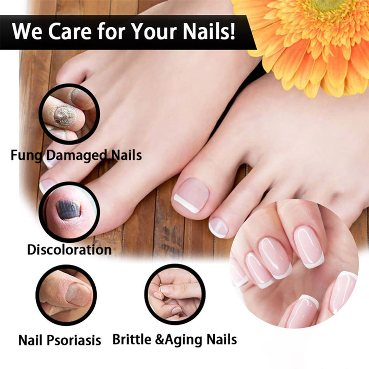 Promotional image for nail care services with a focus on damaged and healthy nails. EELHOE Nail Restoration for Healthy, Shiny Nails EELHOE Nail Restoration Solution Enhances the Thickness and Shine of Nails While Aiding in the Removal of Nail Fungus and Dead Skin, Providing Nourishing Hydration for Nail Care