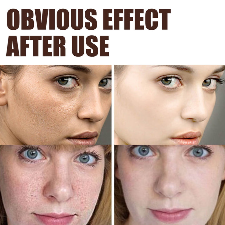 Before and after effects of a cosmetic product on a woman's face. EELHOE Retinol Cream: Hydrating Anti-Aging Solution EELHOE Retinol Cream Age-Defying Tightening Illuminating Hydrating Face Skincare Cream