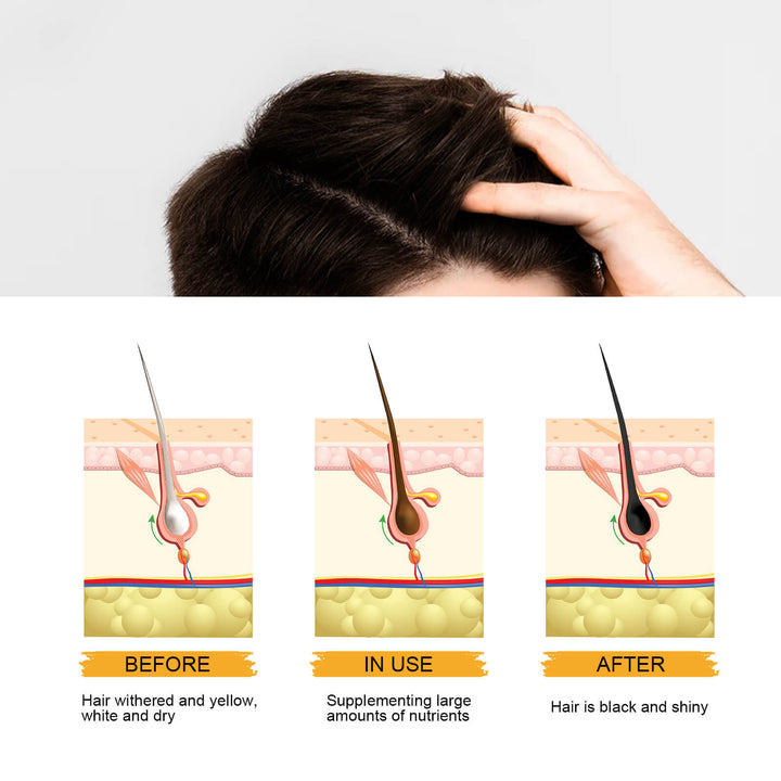 Illustration showing hair health transformation from 'Before' to 'After' with a person touching their hair. East Moon Men's Shampoo Bar for Dark, Glossy Hair East Moon Men's Shampoo Bar Cleanses Hair, Enriches, Dark Hair, Glossy Hair Treatment, Men's Shampoo Bar