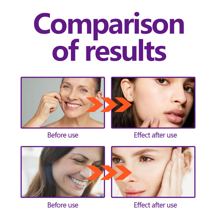 Comparison of results before and after use with a woman's face shown. Hoygi Facial Lifting Cream for Fine Lines & Hydration Hoygi Facial Lifting and Firming Cream Reduces Fine Lines and Nasolabial Folds Soothing and Nourishing Cream for Hydration