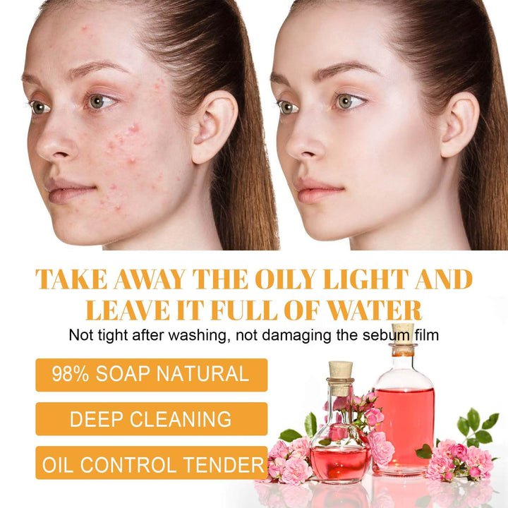 Before and after comparison of a person's face with acne and clear skin, featuring skincare products and text about product benefits. Hoygi Turmeric Cleanser: Clear Skin & Diminish Acne Scars Hoygi Turmeric Cleanser Thoroughly Cleans the Face, Diminishes Acne Scars, Hydrates, Lightens, and Enhances the Appearance of the Skin