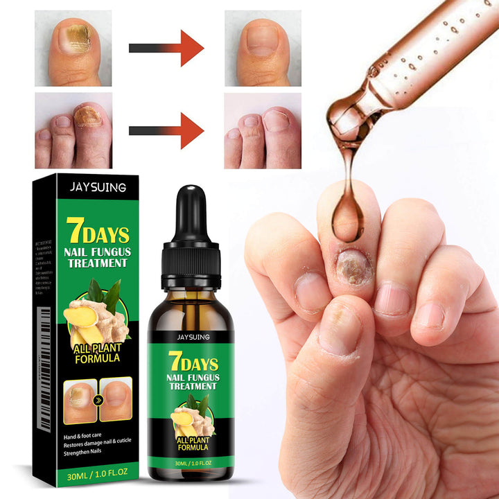 Jaysuing 7 Days Nail Fungus Treatment with dropper, packaging, and before-and-after images. Jaysuing Ginger Nail Treatment for Healthy Nails Jaysuing Ginger Nail Treatment for Hands and Feet Soft Nail Polish Hydrating Solution for Fungal Nail Infection
