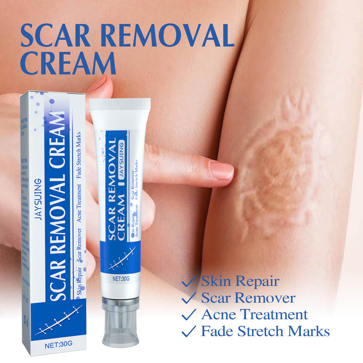 Scar removal cream with packaging and a tube on a light background Jaysuing Scar Cream: Lighten, Smooth, and Firm Skin Jaysuing Scar Cream Cream that Lightens Scars Smoothens Skin firms It Up and Aids In Skin Repair