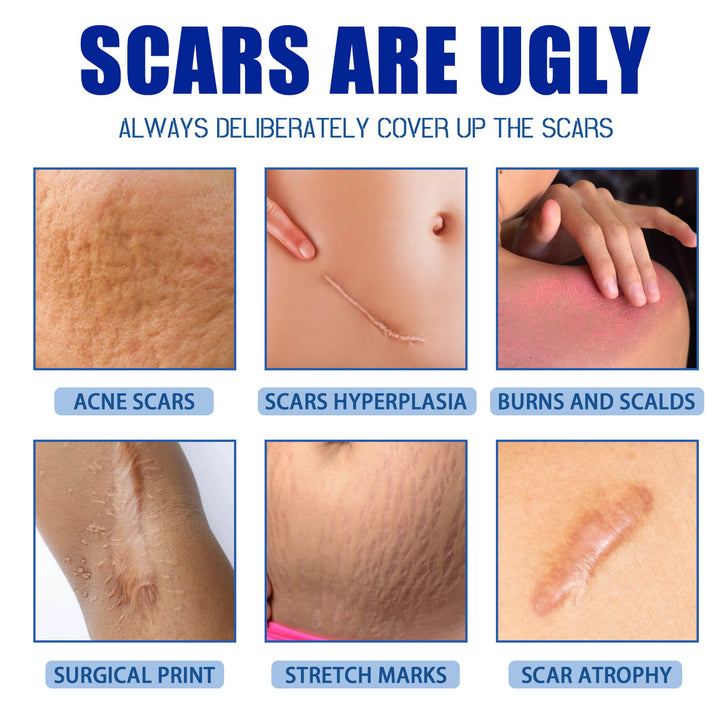 Scars of various types on skin with text 'SCARS ARE UGLY' and 'Always deliberately cover up the scars'. Jaysuing Scar Cream: Lighten, Smooth, and Firm Skin Jaysuing Scar Cream Cream that Lightens Scars Smoothens Skin firms It Up and Aids In Skin Repair