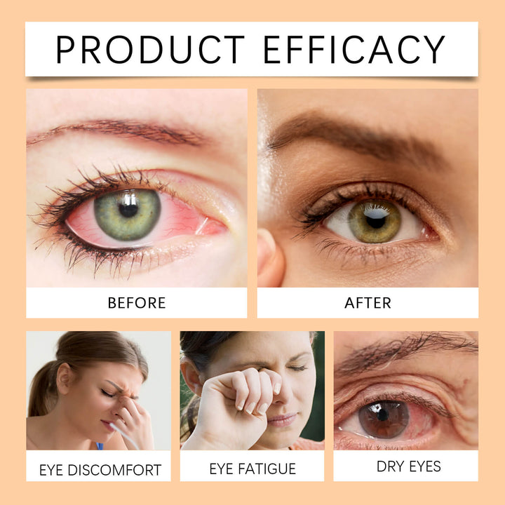 Before and after comparison of eye issues with a product efficacy label. Ximonth Jimerito Bee Honey Eye Care for Dry Eyes Ximonth Jimerito Bee Honey Eye Care Revitalizes and Hydrates Providing Relief for Dry Eyes and Offering Soothing Care Through Its Eye Drops
