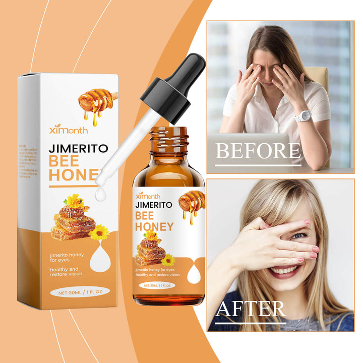 Jimerito Bee Honey product with packaging and before/after images of a woman. Ximonth Jimerito Bee Honey Eye Care for Dry Eyes Ximonth Jimerito Bee Honey Eye Care Revitalizes and Hydrates Providing Relief for Dry Eyes and Offering Soothing Care Through Its Eye Drops